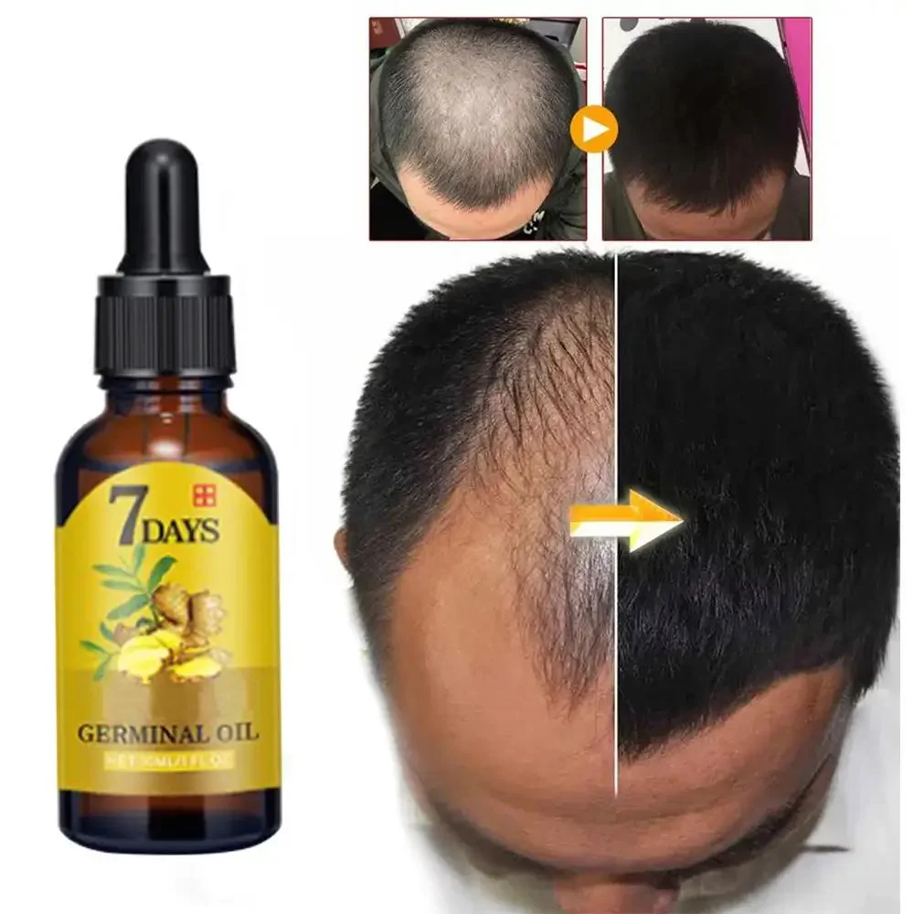 Coconut Oil Pull - Hair Growth Ginger Fast Growing Hair