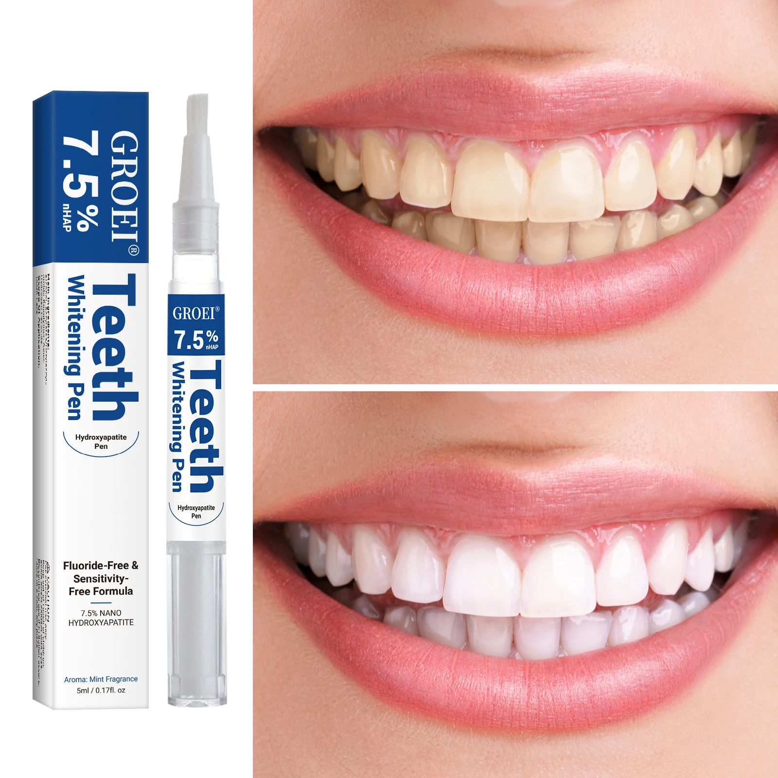 Hydroxyapatite Tooth Whitening – Teeth Whitening With Hydrogen Peroxide recenzja i cena
