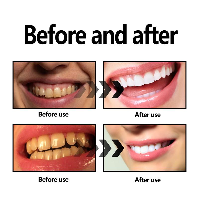 Teeth Whitening Powder Charcoa – Teeth Whitening Charcoal Powder recenzja i cena