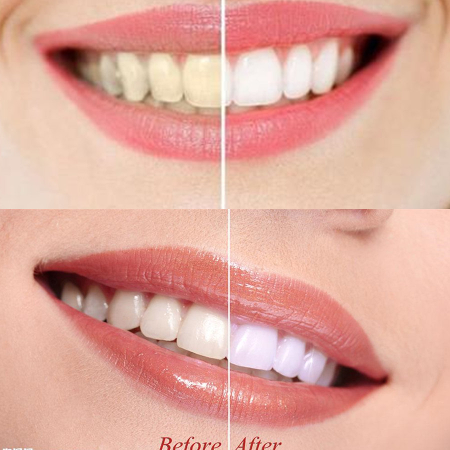 Bamboo Charcoal Teeth Tooth De – Teeth Whitening Charcoal Powder recenzja i cena