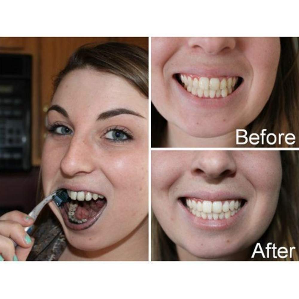 Bamboo Charcoal Teeth Tooth De – Teeth Whitening Charcoal Powder recenzja i cena