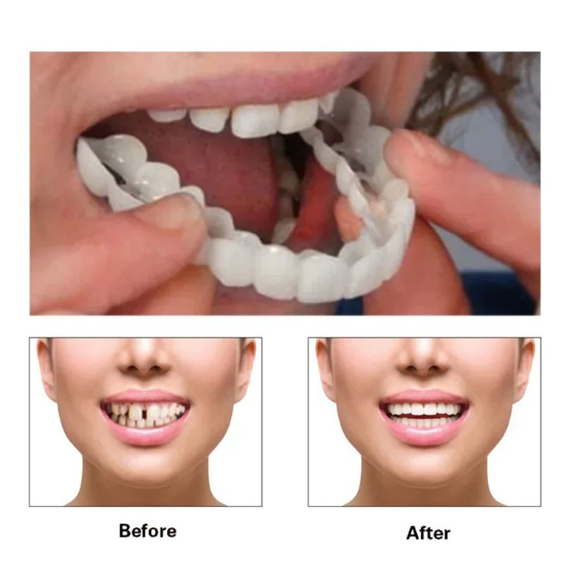 Quick Makeup Teeth Veneers, In – Teeth Whitening Quick recenzja i cena