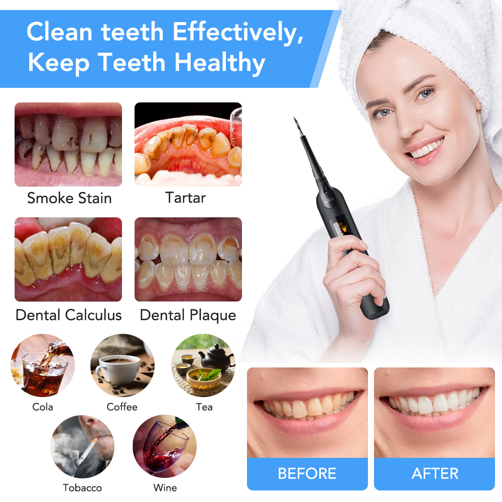 Teeth Tartar Remover Electric  – Teeth Whitening Led Kit recenzja i cena