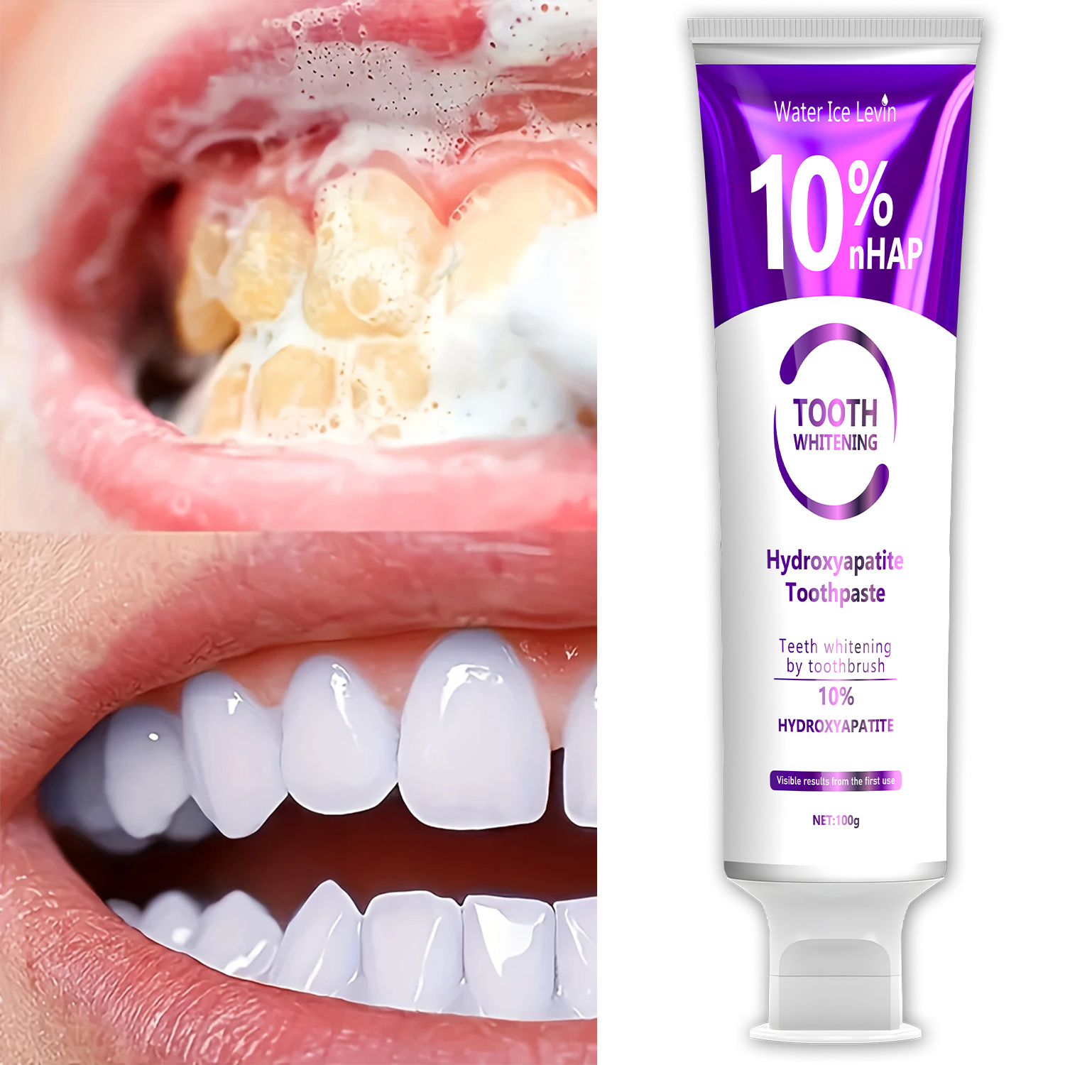 10% Nanoh Hydrogen Oxide Tooth – Teeth Whitening With Hydrogen Peroxide recenzja i cena