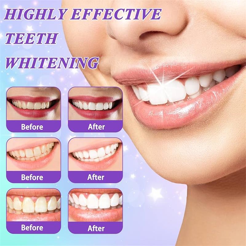 9D Purple Teeth Whitening Toot – Teeth Whitening Cream recenzja i cena
