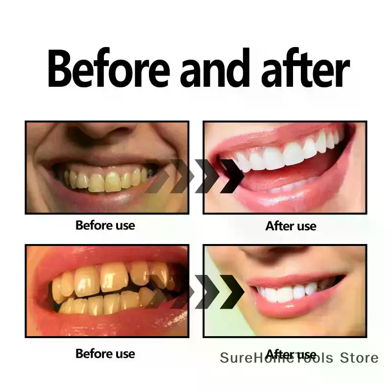 Bamboo Charcoal Powder For Tee – Teeth Whitening Charcoal Powder recenzja i cena