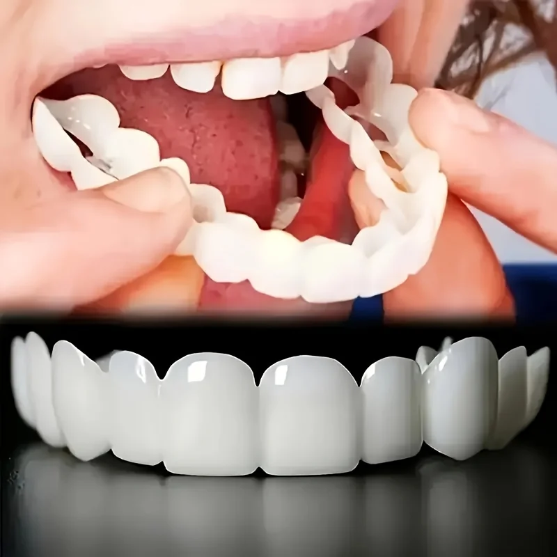 A Whitening Teeth Veneers Reus – Teeth Whitening Quick recenzja i cena
