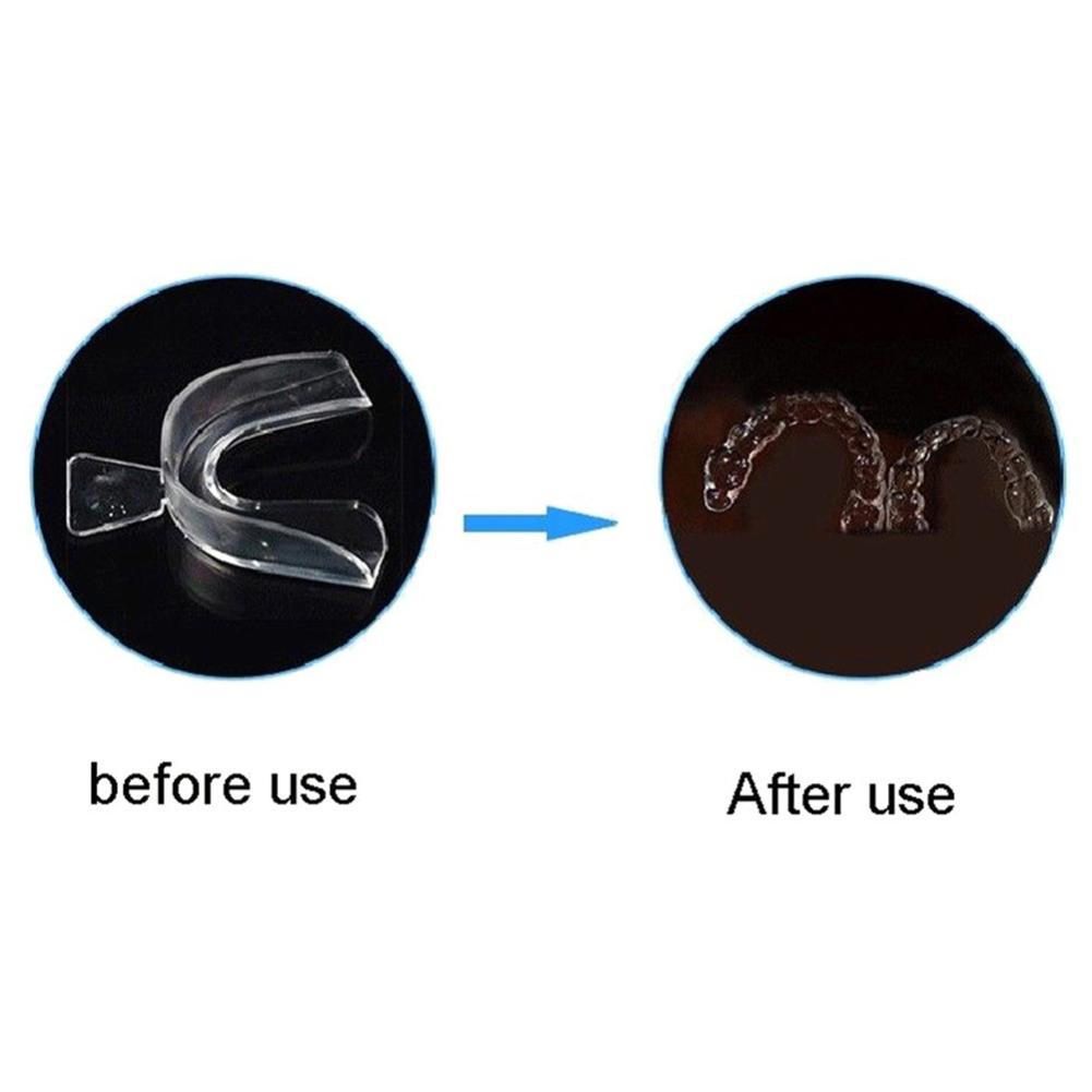 Silicone Mouth Guard Orthodont – Teeth Whitening With Trays recenzja i cena