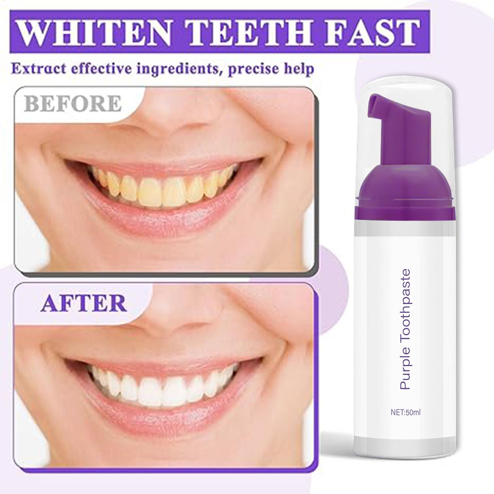 50ml Foam Toothpaste Brighteni – Teeth Whitening Before And After recenzja i cena