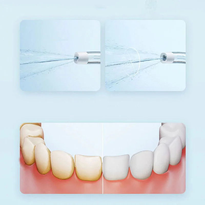 Xiaomi Portable Oral Irrigator – Teeth Whitening Quick recenzja i cena