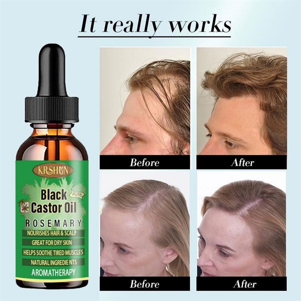 Black Castor Oil Nourishes Hai – Coconut Oil Pull recenzja i cena
