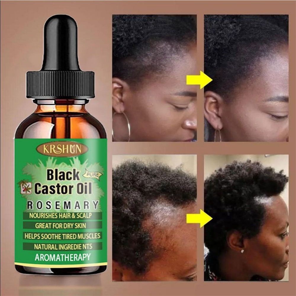 Black Castor Oil Nourishes Hai – Coconut Oil Pull recenzja i cena