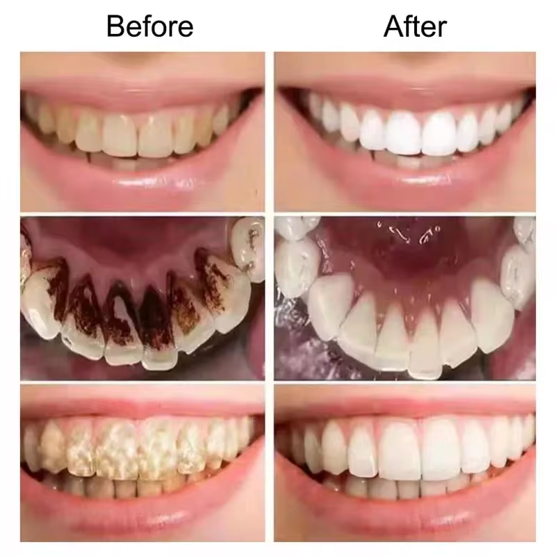 7.5% Hydroxyapatite Probiotic  – Teeth Whitening Cream recenzja i cena