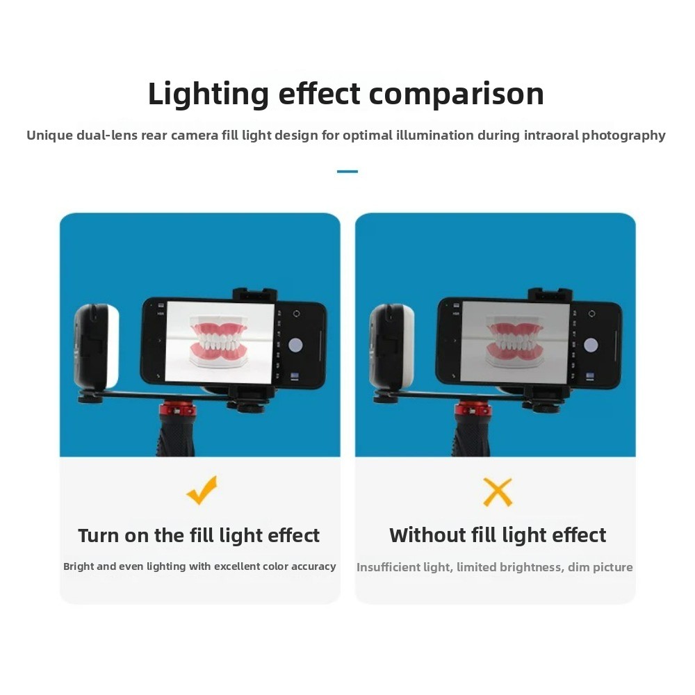 Dental Photography Light, Blue – Teeth Whitening Led Kit recenzja i cena