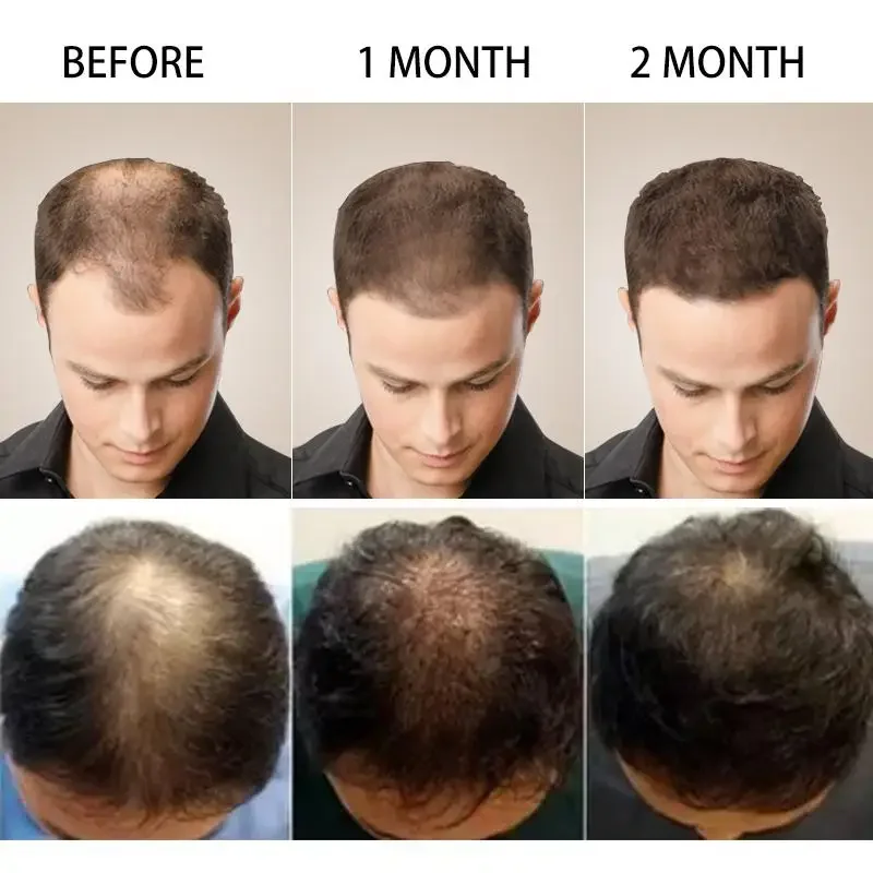 Hair Growth Ginger Fast Growin – Coconut Oil Pull recenzja i cena