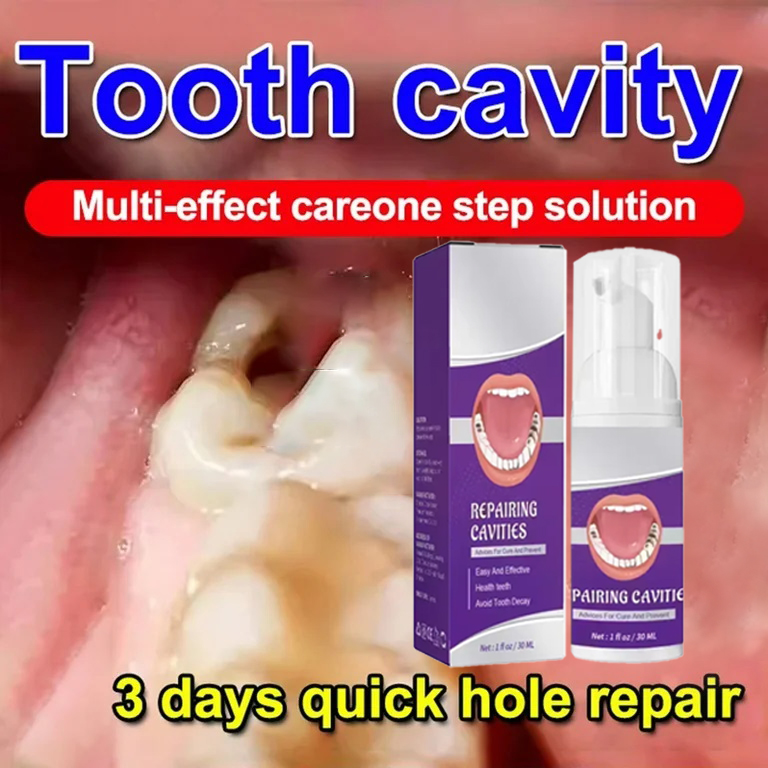 Teeth Cleaning Toothpaste Remo – Teeth Whitening Cream recenzja i cena