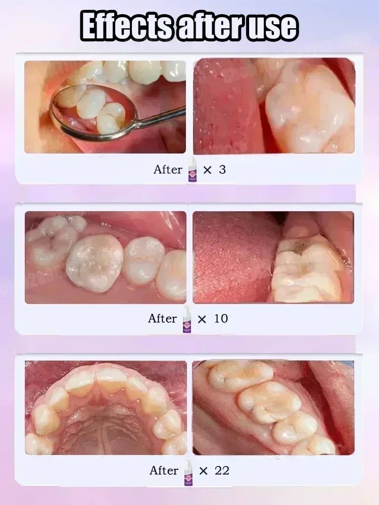 Teeth Cleaning Toothpaste Remo – Teeth Whitening Cream recenzja i cena
