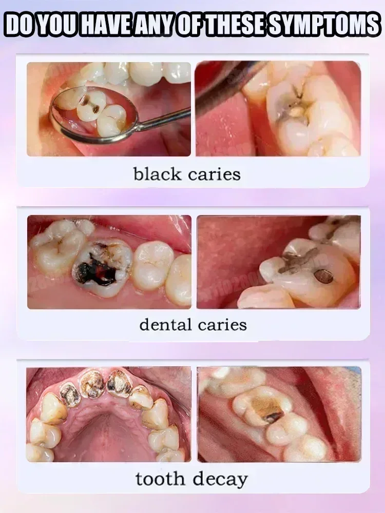 Teeth Cleaning Toothpaste Remo – Teeth Whitening Cream recenzja i cena