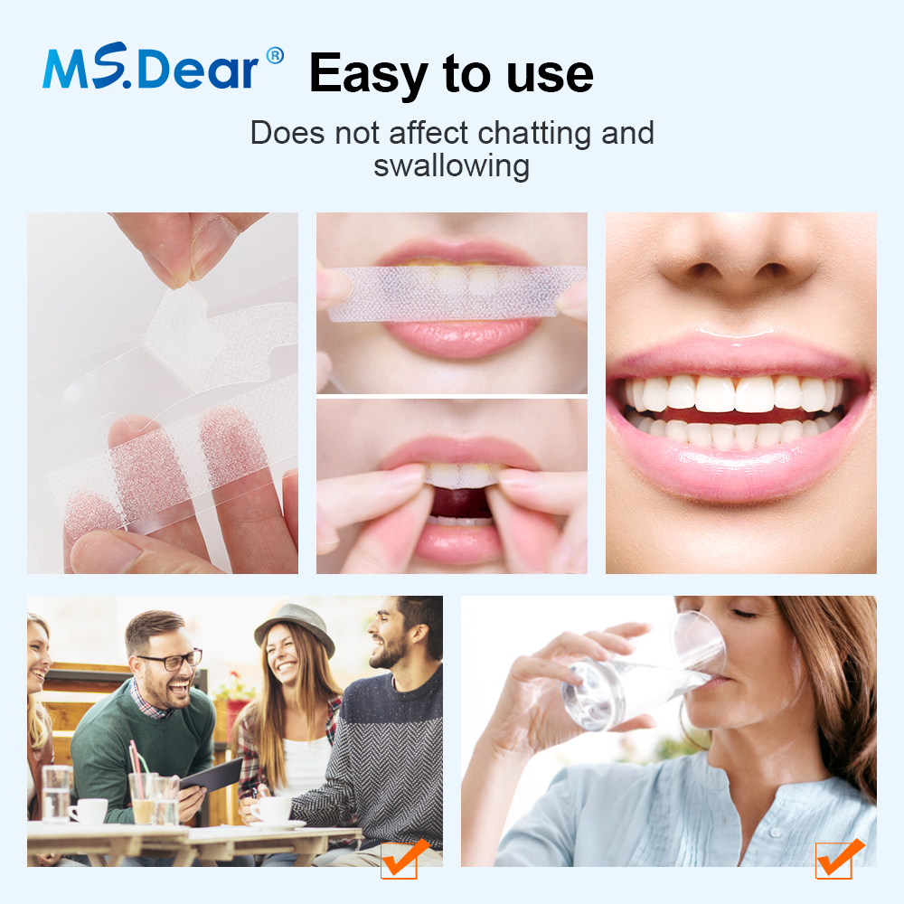 Teeth Whitening Strips Cleansi – Teeth Whitening With Hydrogen Peroxide recenzja i cena